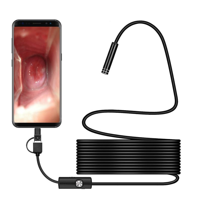 endoscope1